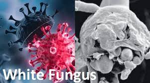 White fungus – Another deadly&nbsp;disease?