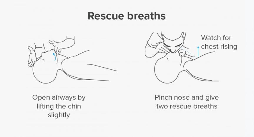 Cardiopulmonary Resuscitation (CPR) – Eduindex