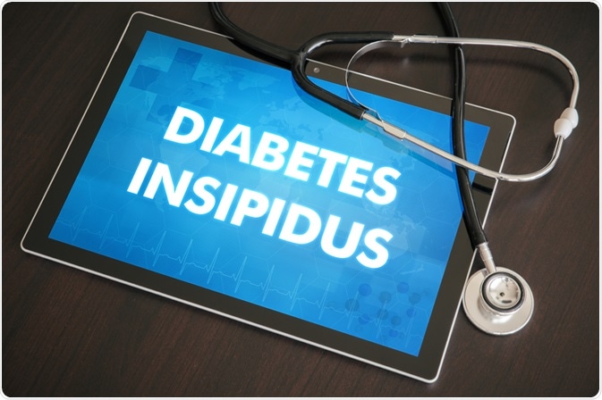 Diabetes insipidus