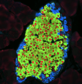 Pancreas Regeneration in Human Regenerative&nbsp;Therapy