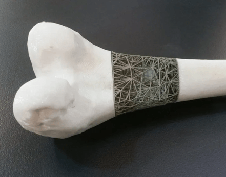 What is Bone Tissue&nbsp;Engineering?